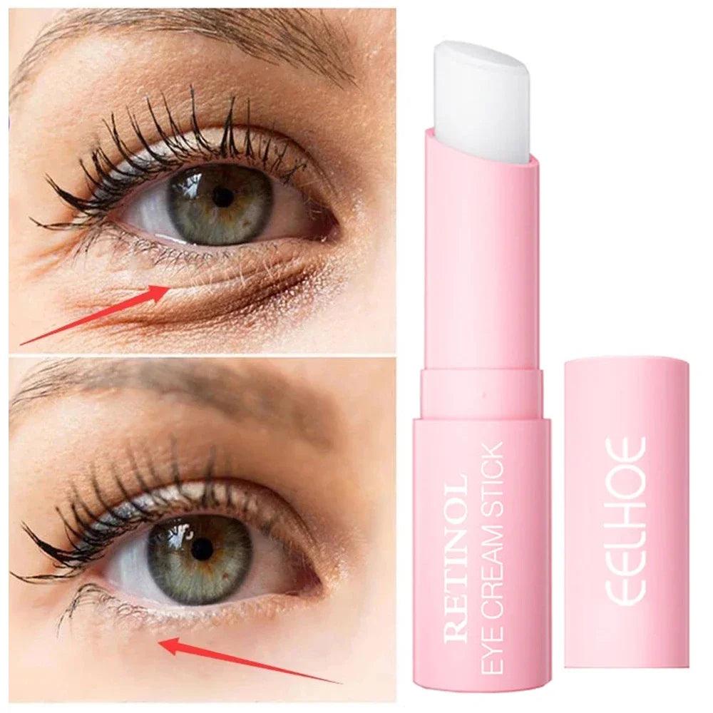 Eye Wrinkles Cream: Removes Wrinkles, Dark Circles & Eye Bags