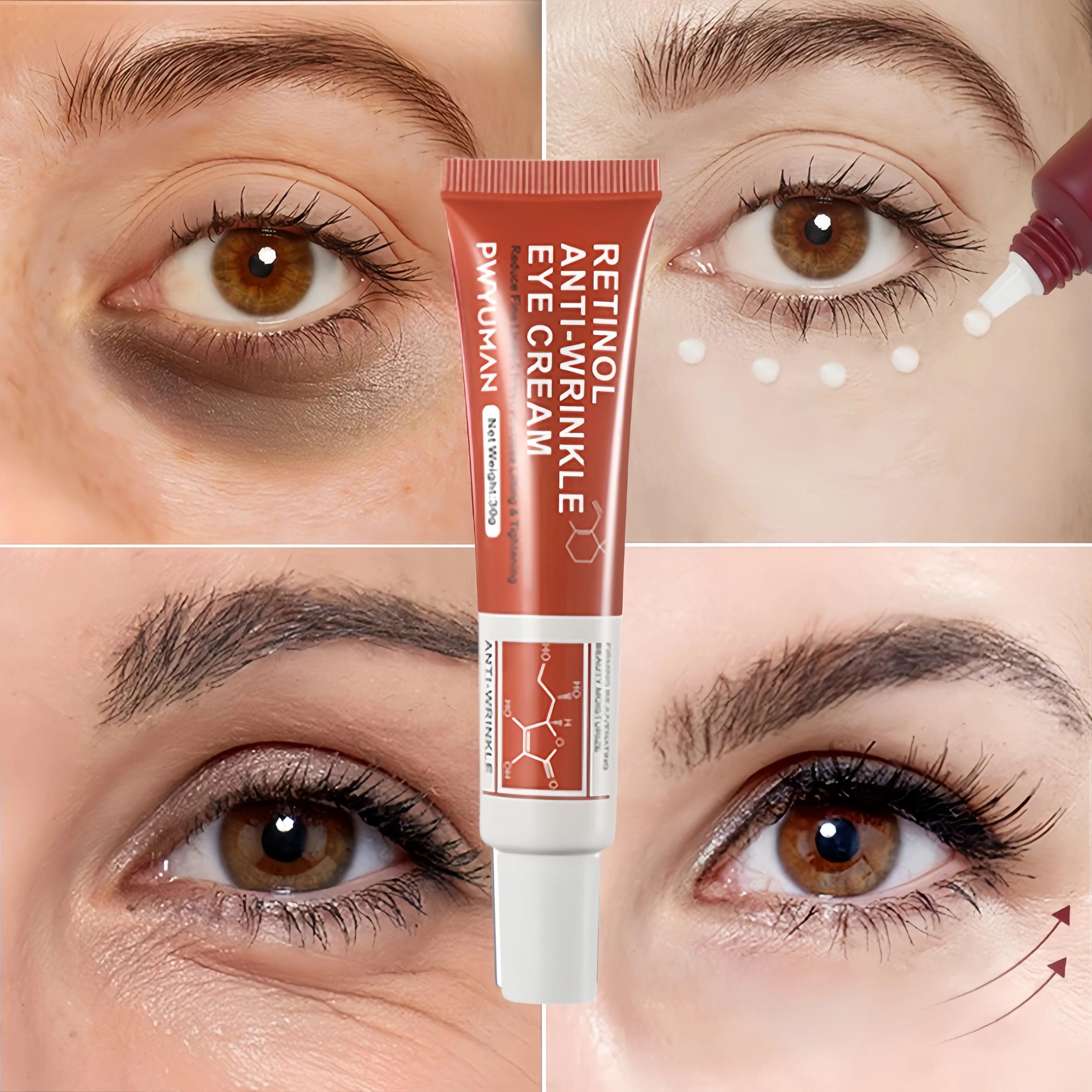 Retinol Eye Cream: Reduces fine lines and dark circles.