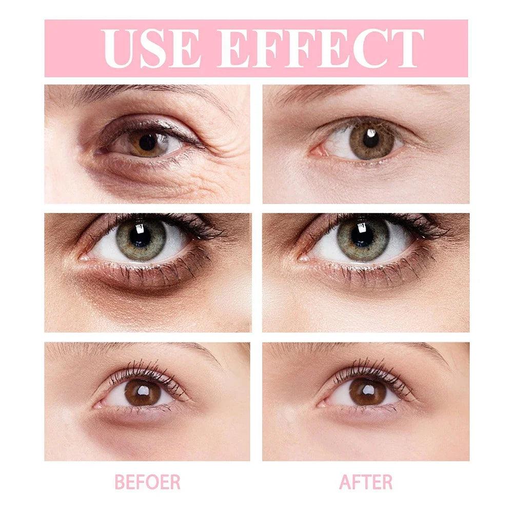 Eye Wrinkles Cream: Removes Wrinkles, Dark Circles & Eye Bags