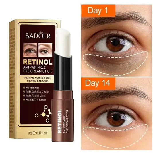 Retinol Eye Cream for Dark Circles - Eye Wrinkles Cream